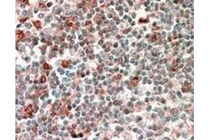 Image no. 3 for anti-Neutrophil Cytosolic Factor 4, 40kDa (NCF4) (Internal Region) antibody (ABIN374770) (NCF4 抗体  (Internal Region))