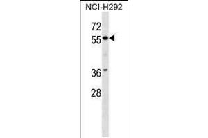 Western blot analysis in NCI-H292 cell line lysates (35ug/lane). (ZNF512 抗体  (N-Term))