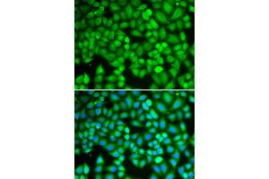 Immunofluorescence analysis of U2OS cells using WAS antibody (ABIN5970366). (WASP 抗体)