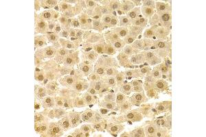 Immunohistochemistry of paraffin-embedded rat liver using CDK4 antibody at dilution of 1:100 (x400 lens). (CDK4 抗体)