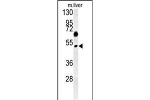 Western blot analysis in mouse liver tissue lysates (15ug/lane). (SNX31 抗体  (N-Term))