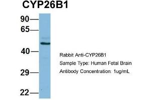 Host: Rabbit  Target Name: CYP26B1  Sample Tissue: Human Fetal Brain  Antibody Dilution: 1. (CYP26B1 抗体  (N-Term))