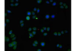 Immunofluorescent analysis of PC-3 cells using ABIN7146178 at dilution of 1:100 and Alexa Fluor 488-congugated AffiniPure Goat Anti-Rabbit IgG(H+L) (ZMPSTE24 抗体  (AA 217-347))