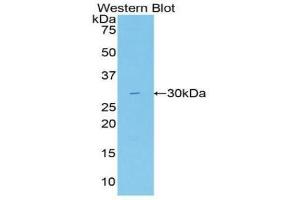 Detection of Recombinant Gallus, Human using Polyclonal Antibody to Fatty Acid Synthase (FASN) (Fatty Acid Synthase 抗体  (AA 2263-2512))