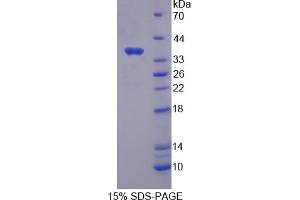 Image no. 1 for Calcium-Sensing Receptor (CASR) (AA 863-1079) protein (His tag) (ABIN6237790) (CASR Protein (AA 863-1079) (His tag))