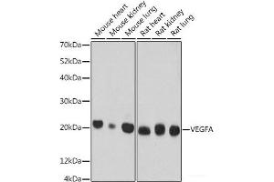 Western blot analysis of extracts of various cell lines using VEGF Monoclonal Antibody at dilution of 1:500. (VEGF 抗体)