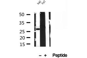 Western blot analysis of extracts of HepG2 cells, using TPI1 antibody. (TPI1 抗体  (C-Term))