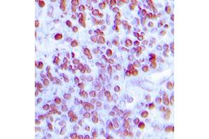 Immunohistochemical analysis of MNDA staining in human lymph node formalin fixed paraffin embedded tissue section.