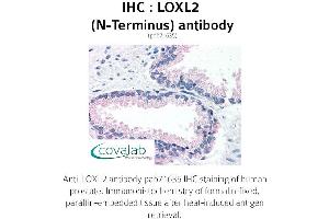 Image no. 2 for anti-Lysyl Oxidase-Like 2 (LOXL2) (N-Term) antibody (ABIN1736517) (LOXL2 抗体  (N-Term))