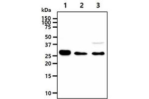 The cell lysates (40ug) were resolved by SDS-PAGE, transferred to PVDF membrane and probed with anti-human IMPA1 antibody (1:1000).