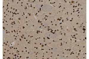 ABIN6279896 at 1/100 staining Rat brain tissue by IHC-P. (USP29 抗体)