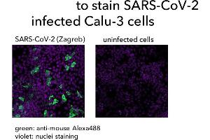 Calu-3 cells were infected with SARS-CoV-2, fixed with formaldehyde and stained with (ABIN7581774) followed by anti-mouse-Alexa488 staining and a nuclear marker. (Recombinant SARS-CoV-2 Nucleocapsid 抗体  (Whole Molecule))