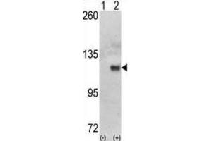 Western Blotting (WB) image for anti-Hexokinase 1 (HK1) antibody (ABIN3003712) (Hexokinase 1 抗体)