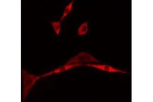 ABIN6275497 staining A549 cells by IF/ICC. (ARHGEF16 抗体  (Internal Region))