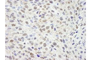 Immunohistochemistry (IHC) image for anti-Cell Division Cycle and Apoptosis Regulator 1 (CCAR1) (AA 1-50) antibody (ABIN7448463) (CCAR1 抗体  (AA 1-50))