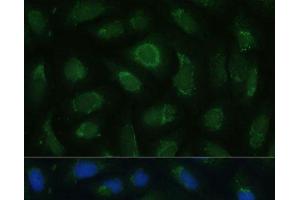Immunofluorescence analysis of U-2 OS cells using SIGLEC9 Polyclonal Antibody at dilution of 1:100 (40x lens). (SIGLEC9 抗体)