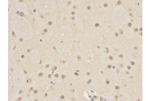 Immunohistochemistry (IHC) image for anti-Autophagy related 4A Cysteine Peptidase (ATG4A) antibody (ABIN1871138) (ATG4A 抗体)