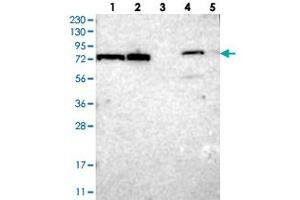 Western blot analysis of Lane 1: RT-4, Lane 2: U-251 MG, Lane 3: Human Plasma, Lane 4: Liver, Lane 5: Tonsil with TTC14 polyclonal antibody  at 1:250-1:500 dilution. (TTC14 抗体)