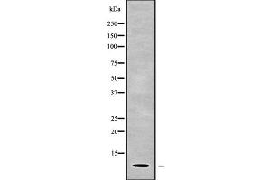 Western blot analysis of PART1 using HuvEc whole cell lysates (PART1 抗体)