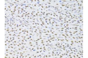 Immunohistochemistry of paraffin-embedded human adenomyosis using FKBP4 Antibody (ABIN5973289) at dilution of 1/100 (40x lens). (FKBP4 抗体)