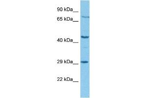 Western Blotting (WB) image for anti-Tryptophan 2,3-Dioxygenase (TDO2) (N-Term) antibody (ABIN2782334)