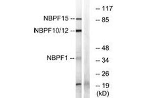 Western blot analysis of extracts from 293/HepG2/Jurkat/COLO cells, using NBPF1/9/10/12/14/15/16/20 Antibody. (NBPF1,9,10,12,14,15,16,20 (AA 121-150) 抗体)