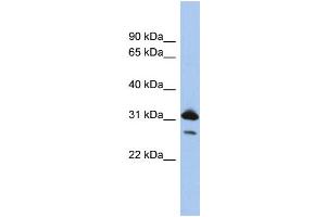 WB Suggested Anti-RAP1B  Antibody Titration: 0. (RAP1B 抗体  (N-Term))