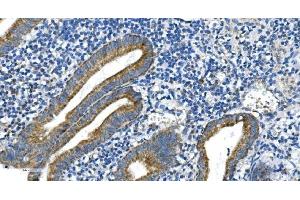 IHC analysis of DRP1/DNM1L using anti-DRP1/DNM1L antibody (ABIN7602180). (Dynamin 1-Like 抗体  (AA 618-736))