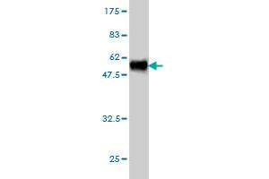 Western Blot detection against Immunogen (49. (HPRT1 抗体  (AA 1-218))