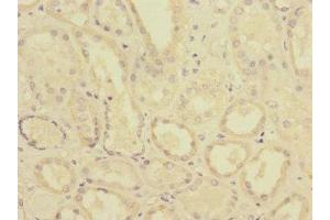 Immunohistochemistry of paraffin-embedded human kidney tissue using ABIN7174111 at dilution of 1:100 (PTPN4 抗体  (AA 1-240))