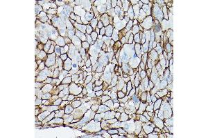 Immunohistochemistry (IHC) image for anti-Catenin (Cadherin-Associated Protein), delta 1 (CTNND1) (AA 573-832) antibody (ABIN3022309)