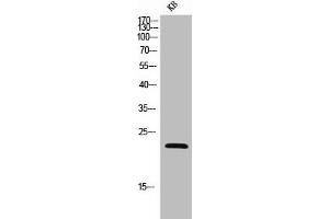 Western Blot analysis of KB cells using NKp30 Polyclonal Antibody (NCR3 抗体  (Extracellular Domain, Transmembrane Domain))