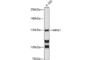 Western blot analysis of extracts of K-562 cells, using HFM1 antibody (ABIN6133318, ABIN6141741, ABIN6141743 and ABIN6224711) at 1:500 dilution. (HFM1 抗体  (AA 1-240))