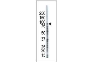 Image no. 1 for anti-Ubiquitin Specific Peptidase 8 (USP8) (C-Term) antibody (ABIN357537) (USP8 抗体  (C-Term))