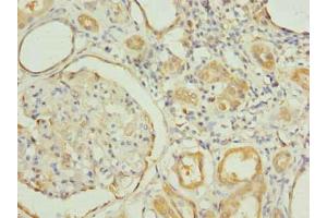 Immunohistochemistry of paraffin-embedded human kidney tissue using ABIN7151188 at dilution of 1:100 (RNF31 抗体  (AA 421-700))