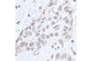 anti-Structural Maintenance of Chromosomes 1A (SMC1A) (pSer966) antibody