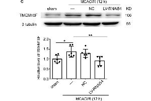 LV-TMEM16F-RNAi transfection downregulates TMEM16F in rat brain.