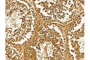 ABIN6262098 and ABIN6269010 at 1/100 staining Rat testis tissue by IHC-P.