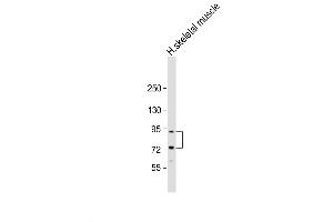 Western Blot at 1:2000 dilution + human skeletal muscle lysate Lysates/proteins at 20 ug per lane. (LTK 抗体  (N-Term))