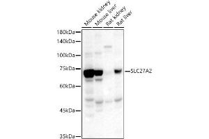 Western Blotting (WB) image for anti-Solute Carrier Family 27 (Fatty Acid Transporter), Member 2 (SLC27A2) (AA 30-200) antibody (ABIN1513532)