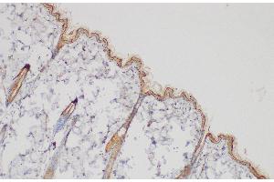 Immunohistochemistry of paraffin-embedded Rat skin using SERPINB2 Polycloanl Antibody at dilution of 1:200