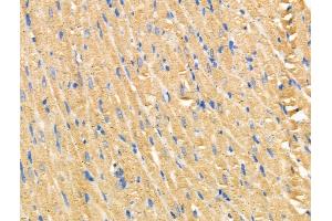 ABIN6258272 and ABIN6274405 at 1/100 staining Rat heart tissue by IHC-P. (MARK2 抗体  (Internal Region))