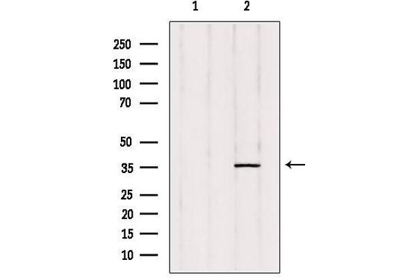 PTGR2 抗体  (Internal Region)