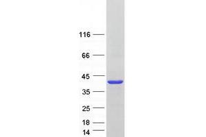 Western Blotting (WB) image for Phytanoyl-CoA 2-Hydroxylase Interacting Protein (PHYHIP) (Transcript Variant 1) protein (Myc-DYKDDDDK Tag) (ABIN2728873)