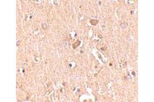 Immunohistochemical staining of human brain tissue with 2. (MED28 抗体  (Internal Region))
