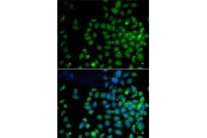 Immunofluorescence analysis of A-549 cells using F/F/UBD antibody (ABIN6131598, ABIN6149778, ABIN6149780 and ABIN6221159). (UBD 抗体  (AA 1-165))