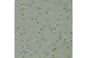 Immunohistochemistry of paraffin-embedded mouse brain using RSRC1 antibody (ABIN5974341) at dilution of 1/100 (40x lens). (RSRC1 抗体)