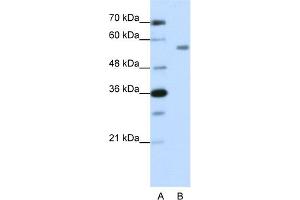 WB Suggested Anti-ZNF497 Antibody Titration:  1. (ZNF497 抗体  (N-Term))