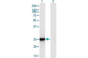Western Blot analysis of FIGLA expression in transfected 293T cell line by FIGLA monoclonal antibody (M03), clone 6A10. (FIGLA 抗体  (AA 110-219))