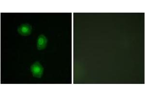 Immunofluorescence analysis of A549 cells, using MSK1 (Ab-376) Antibody. (MSK1 抗体  (AA 343-392))